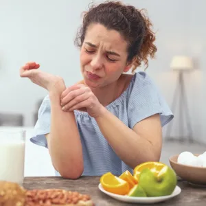 Alergias-e-intolerancias-alimentarias